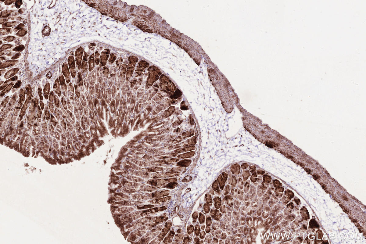 Immunohistochemical analysis of paraffin-embedded mouse stomach tissue slide using KHC2585 (LPCAT3 IHC Kit).