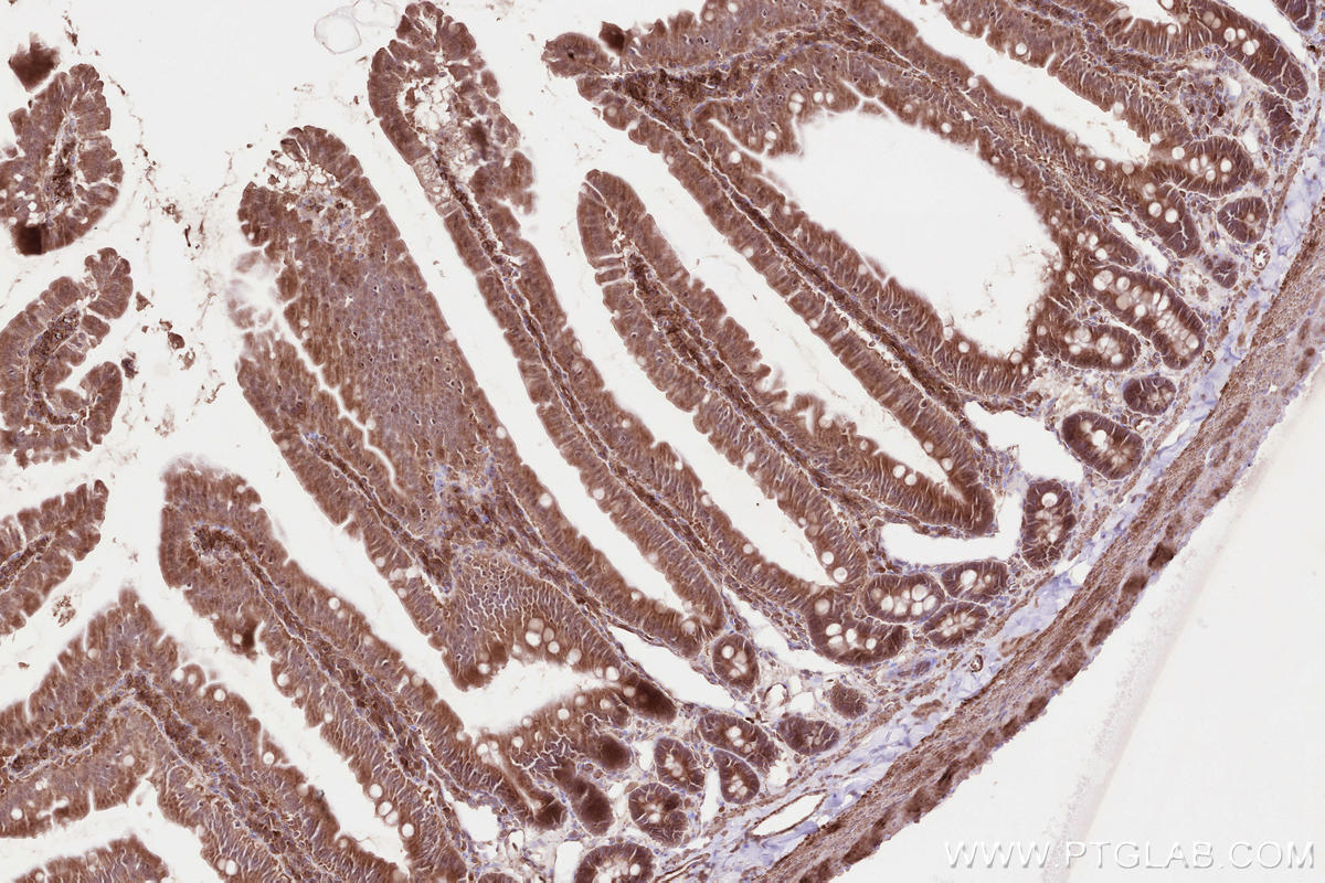 Immunohistochemical analysis of paraffin-embedded rat small intestine tissue slide using KHC2585 (LPCAT3 IHC Kit).
