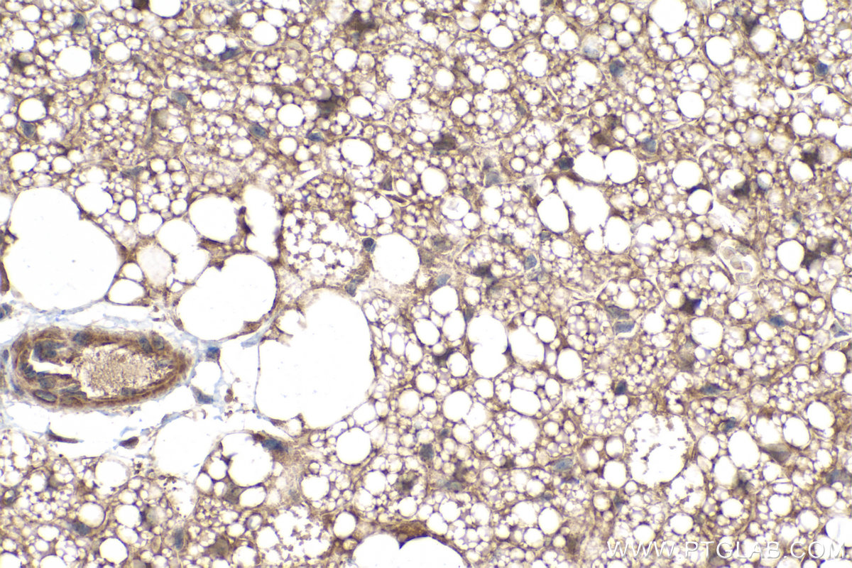 Immunohistochemical analysis of paraffin-embedded mouse brown adipose tissue slide using KHC0233 (LPL IHC Kit).