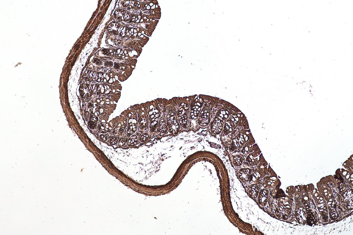 Immunohistochemical analysis of paraffin-embedded mouse colon tissue slide using KHC0675 (LPP IHC Kit).