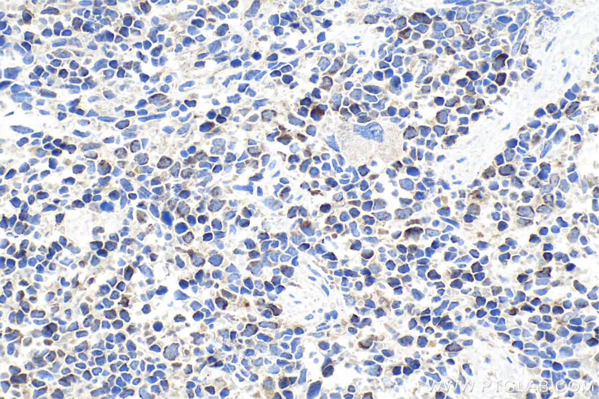 Immunohistochemical analysis of paraffin-embedded mouse spleen tissue slide using KHC1468 (LPXN IHC Kit).