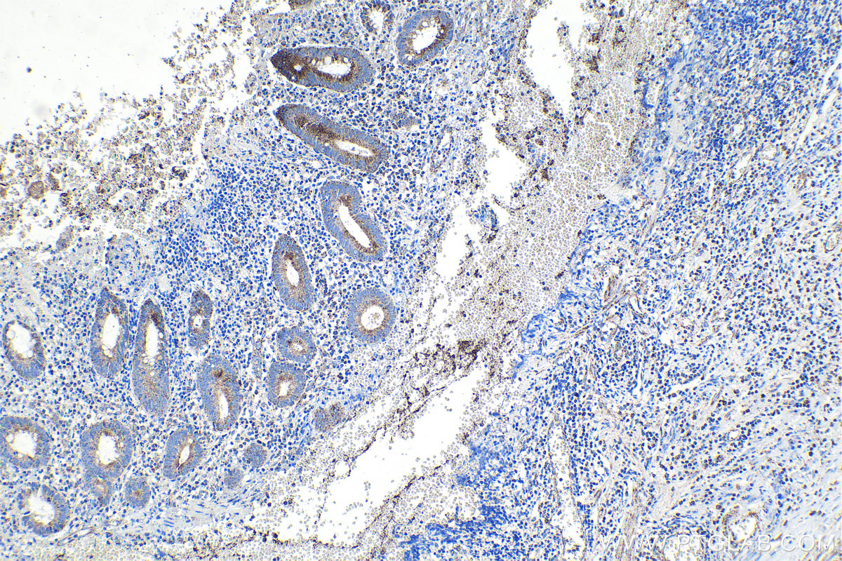 Immunohistochemical analysis of paraffin-embedded human appendicitis tissue slide using KHC1468 (LPXN IHC Kit).