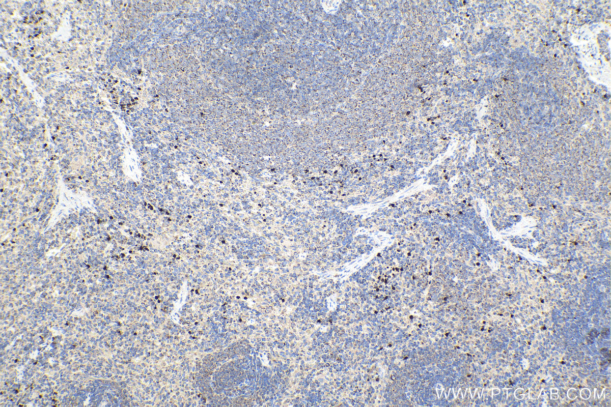 Immunohistochemical analysis of paraffin-embedded rat spleen tissue slide using KHC1468 (LPXN IHC Kit).