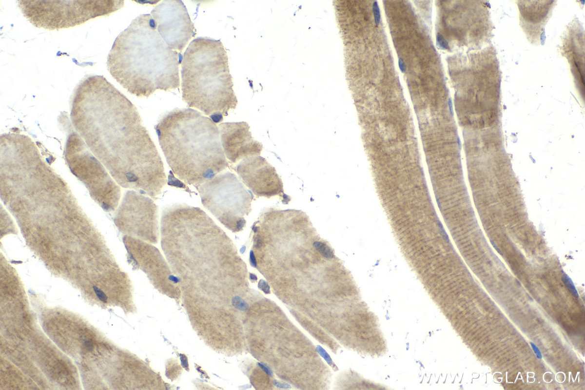 Immunohistochemical analysis of paraffin-embedded mouse skeletal muscle tissue slide using KHC2141 (LRAT IHC Kit).