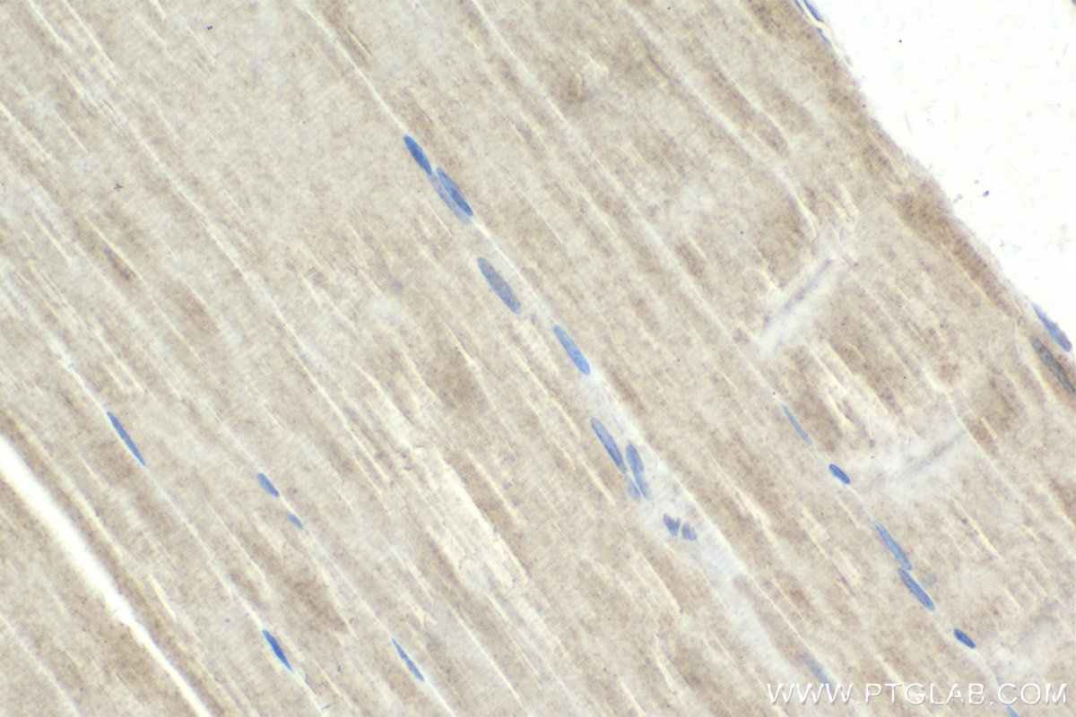 Immunohistochemical analysis of paraffin-embedded rat skeletal muscle tissue slide using KHC2141 (LRAT IHC Kit).