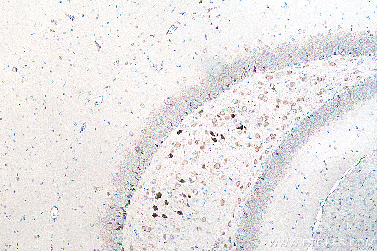 Immunohistochemical analysis of paraffin-embedded mouse brain tissue slide using KHC0222 (LRPAP1 IHC Kit).