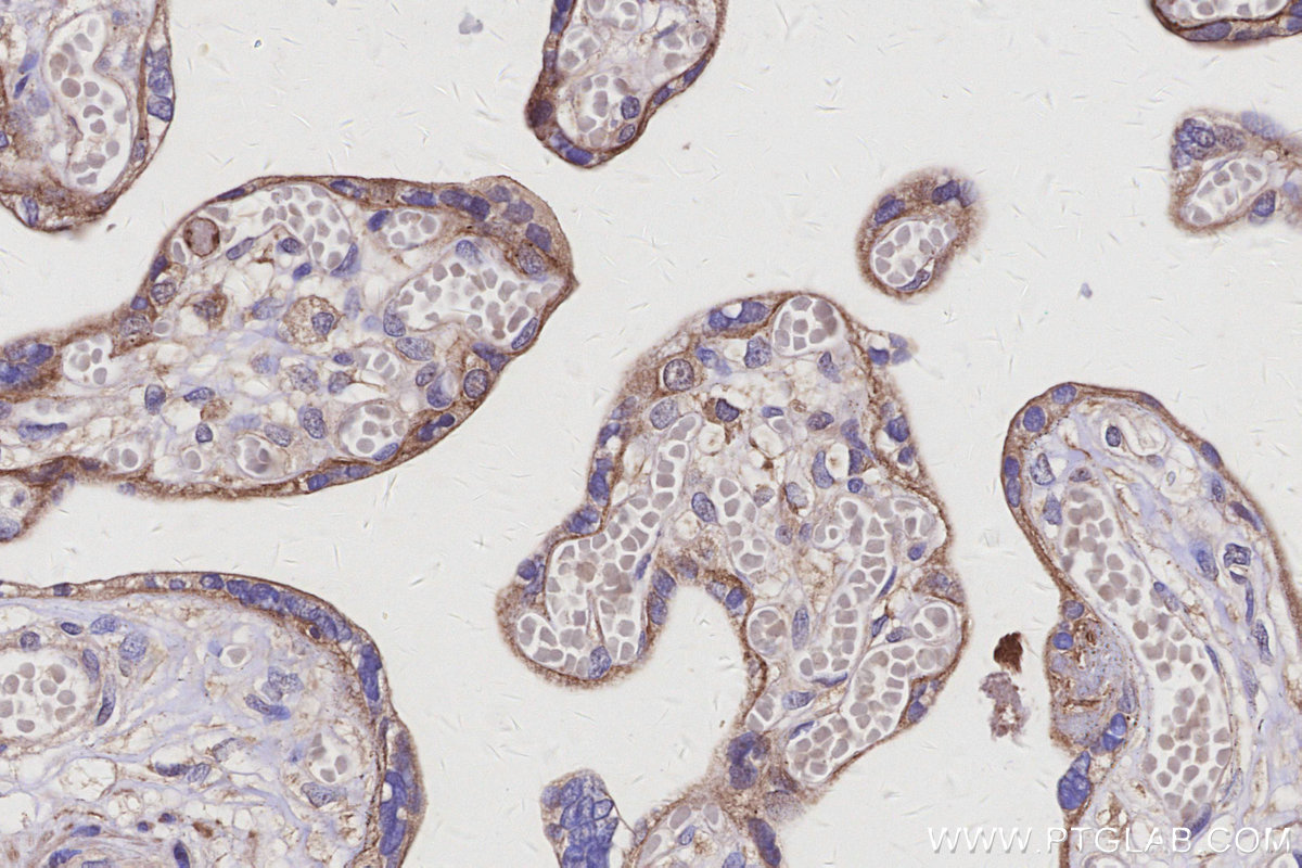 Immunohistochemical analysis of paraffin-embedded human placenta tissue slide using KHC3115 (LRRC1 IHC Kit). Immunohistochemical analysis of paraffin-embedded human placenta tissue slide using KHC3115 (LRRC1 IHC Kit).