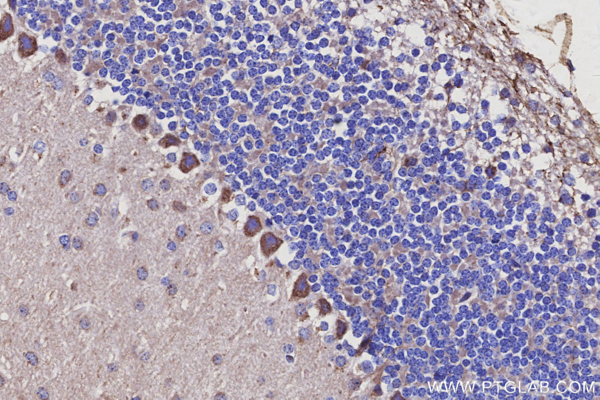 Immunohistochemical analysis of paraffin-embedded mouse cerebellum tissue slide using KHC3115 (LRRC1 IHC Kit). Immunohistochemical analysis of paraffin-embedded mouse cerebellum tissue slide using KHC3115 (LRRC1 IHC Kit).