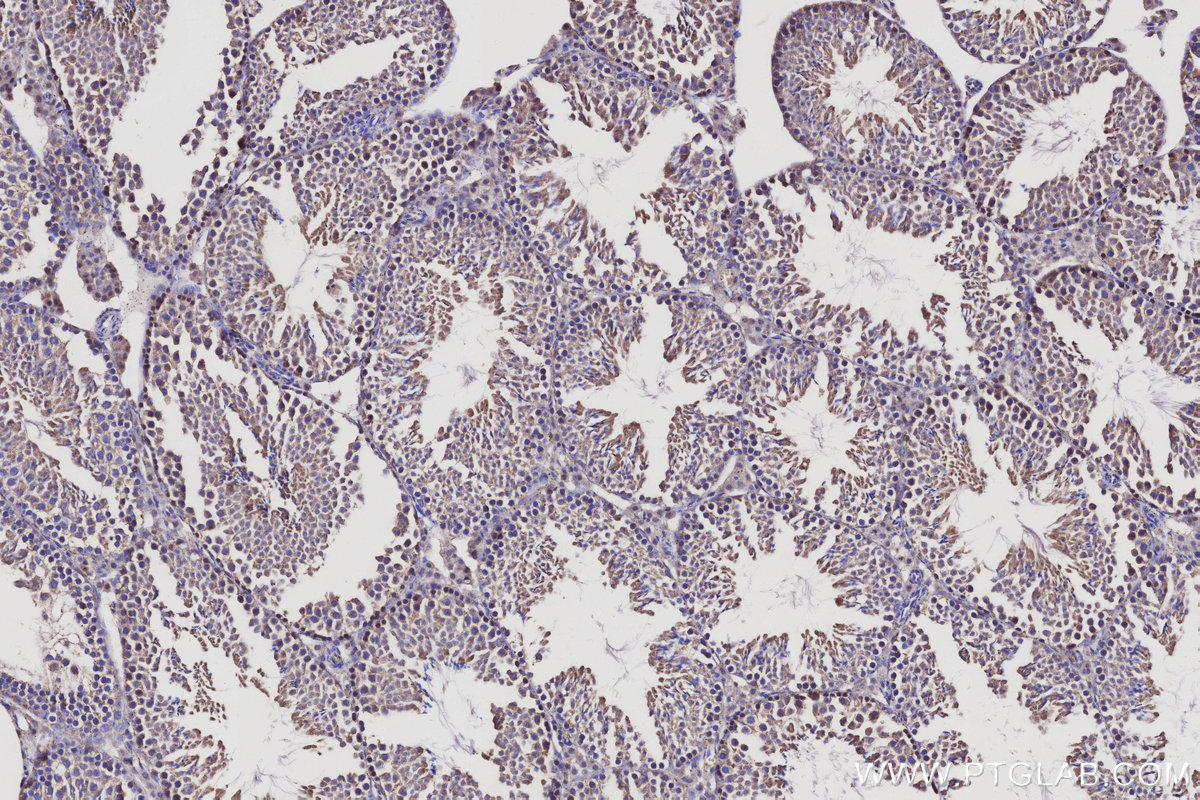 Immunohistochemical analysis of paraffin-embedded mouse testis tissue slide using KHC3115 (LRRC1 IHC Kit). Immunohistochemical analysis of paraffin-embedded mouse testis tissue slide using KHC3115 (LRRC1 IHC Kit).