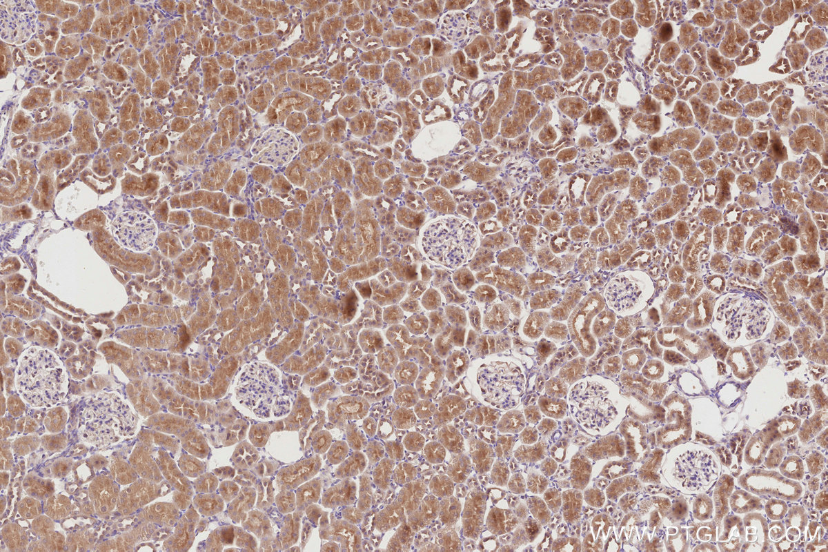 Immunohistochemical analysis of paraffin-embedded rat kidney tissue slide using KHC2856 (LZTS2 IHC Kit).