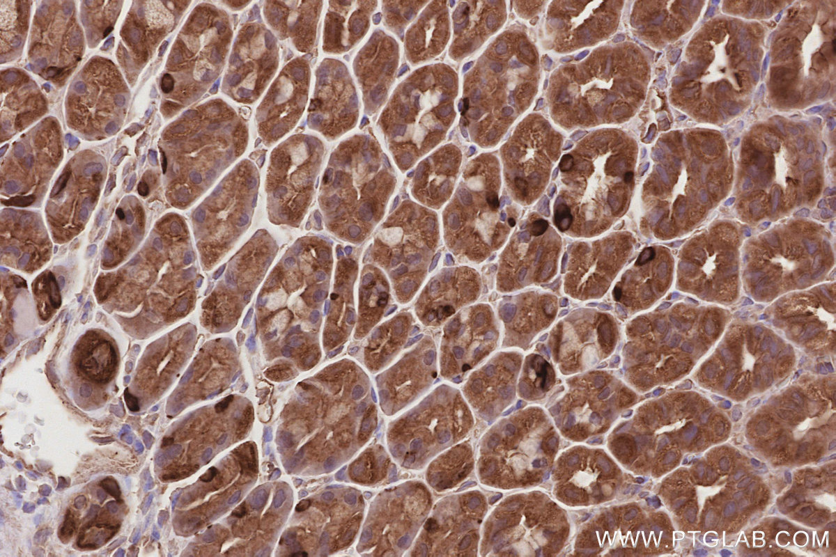 Immunohistochemical analysis of paraffin-embedded mouse stomach tissue slide using KHC2856 (LZTS2 IHC Kit).