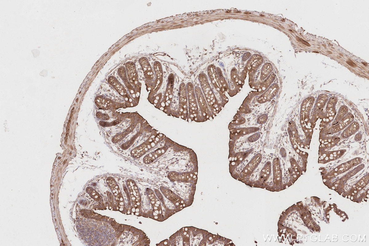 Immunohistochemical analysis of paraffin-embedded mouse colon tissue slide using KHC2856 (LZTS2 IHC Kit).