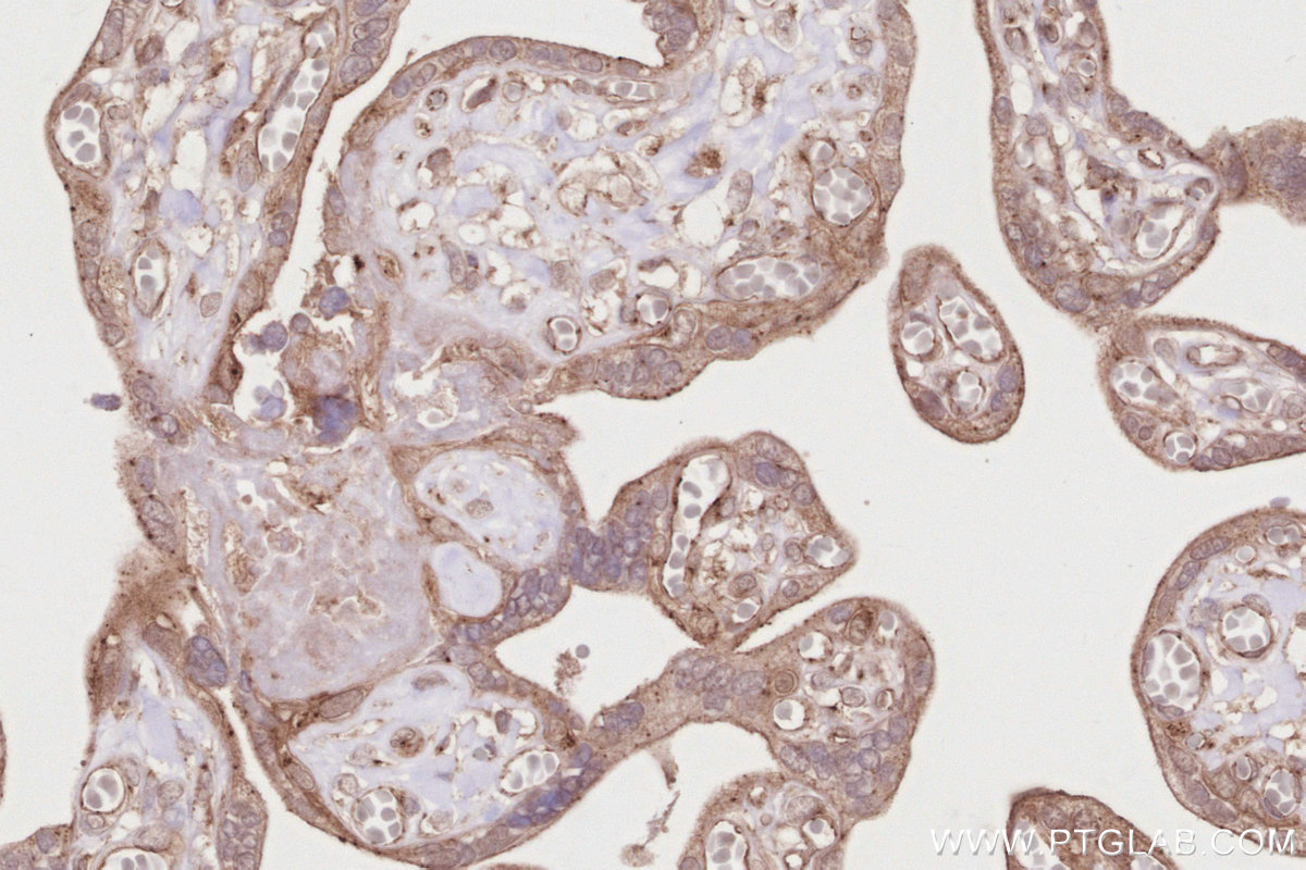 Immunohistochemical analysis of paraffin-embedded human placenta tissue slide using KHC2856 (LZTS2 IHC Kit).