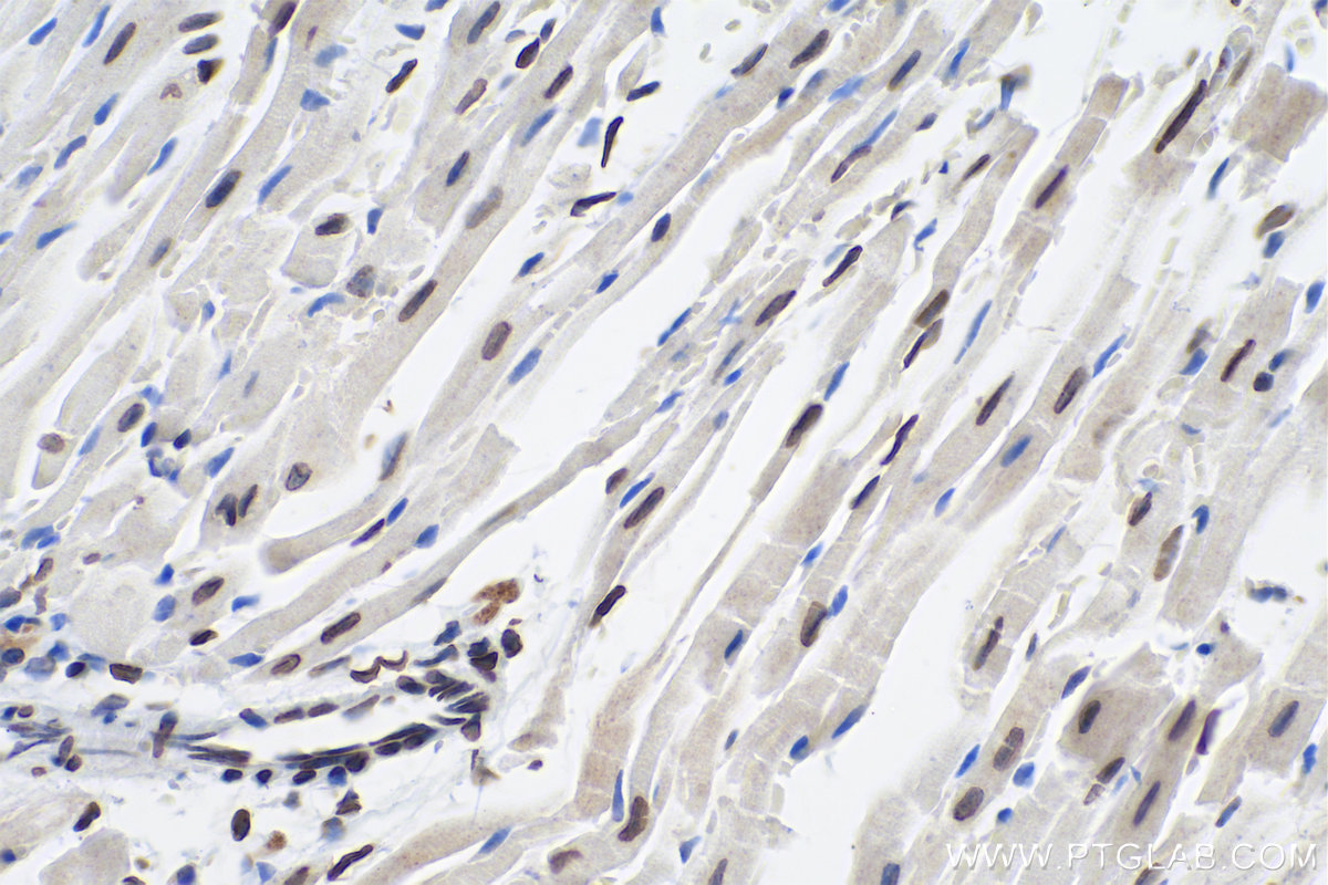 Immunohistochemical analysis of paraffin-embedded mouse heart tissue slide using KHC0311 (Lamin A/C IHC Kit).