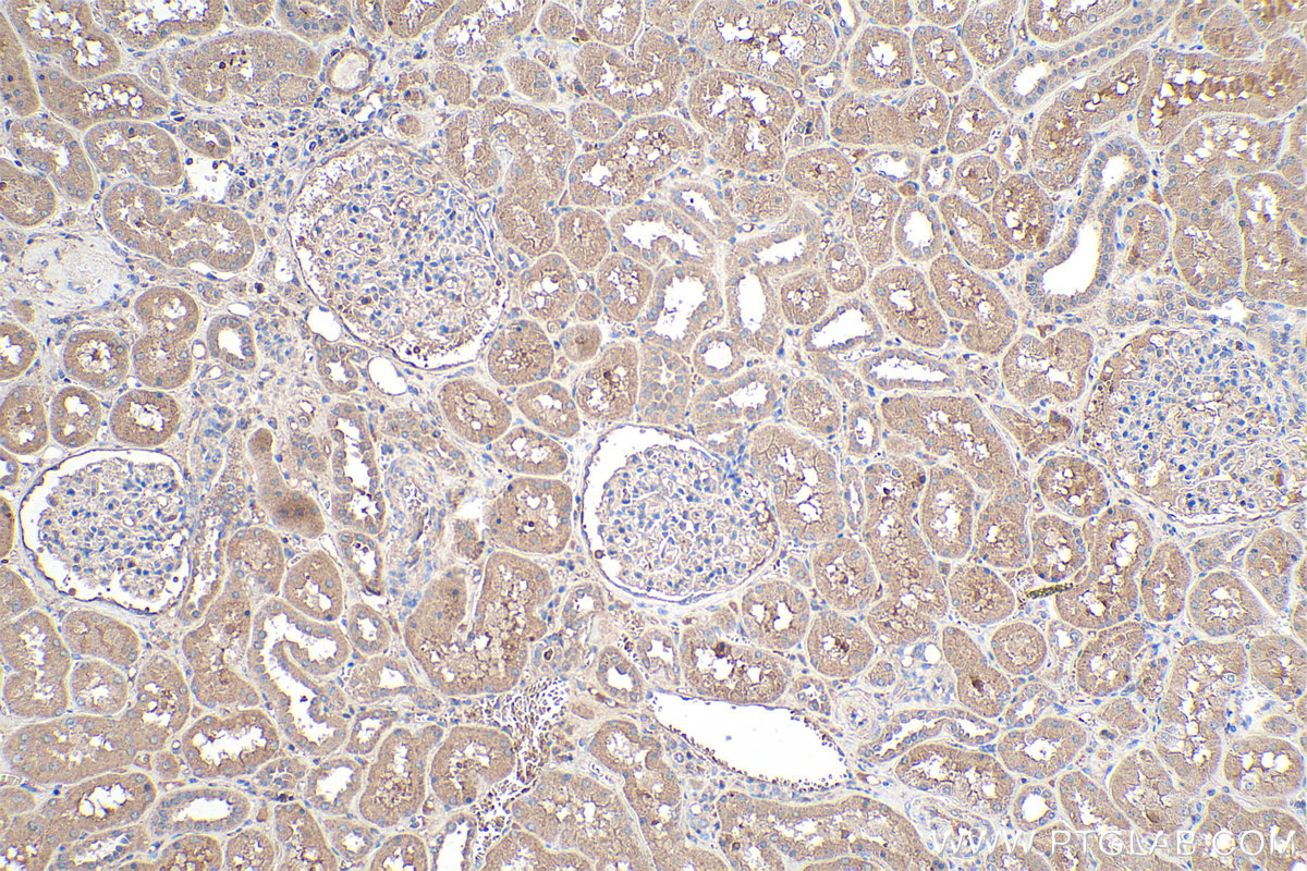 Immunohistochemical analysis of paraffin-embedded human kidney tissue slide using KHC0234 (Leptin IHC Kit).