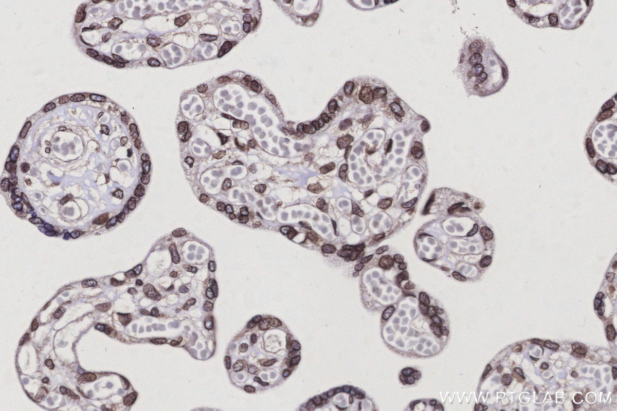 Immunohistochemical analysis of paraffin-embedded human placenta tissue slide using KHC3089 (MAD1L1/MAD1 IHC Kit). Immunohistochemical analysis of paraffin-embedded human placenta tissue slide using KHC3089 (MAD1L1/MAD1 IHC Kit).