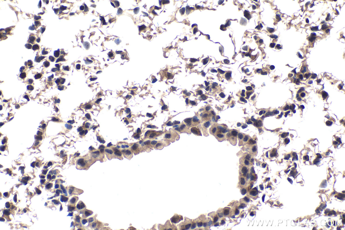 Immunohistochemical analysis of paraffin-embedded mouse lung tissue slide using KHC1987 (MAD2L2 IHC Kit).