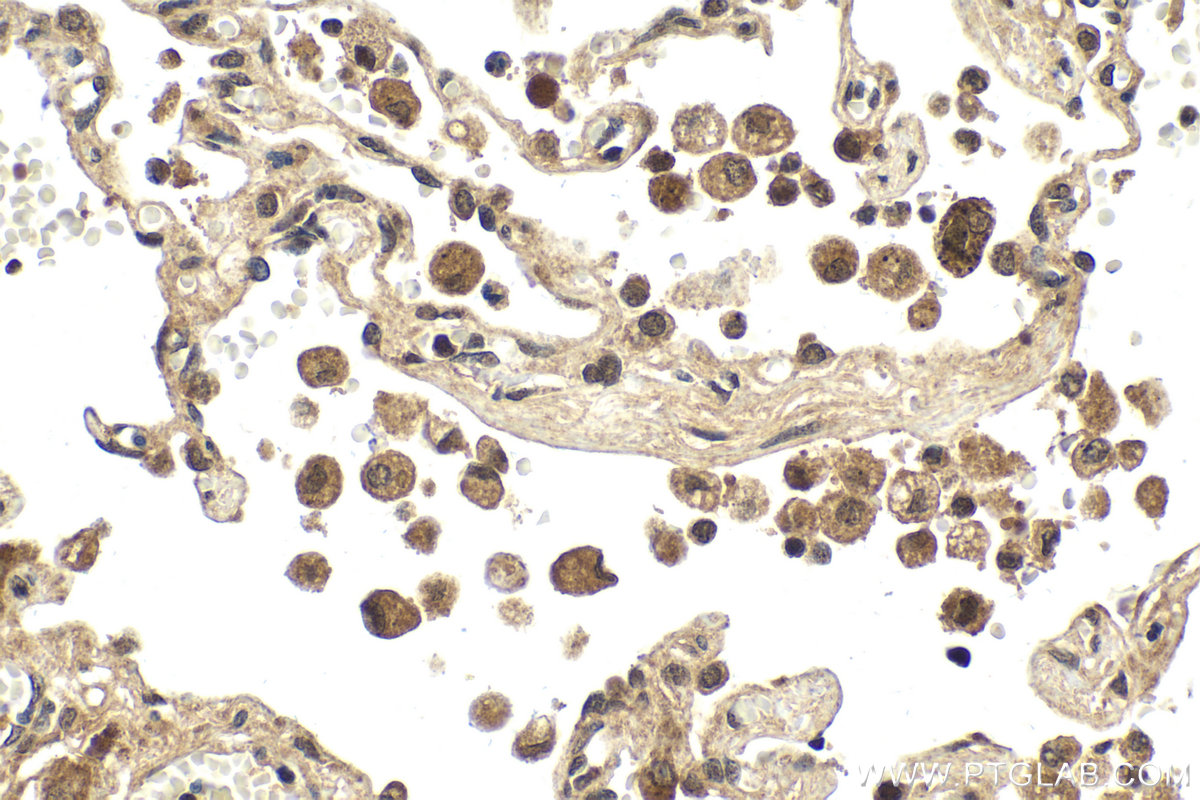 Immunohistochemical analysis of paraffin-embedded human lung tissue slide using KHC1987 (MAD2L2 IHC Kit).