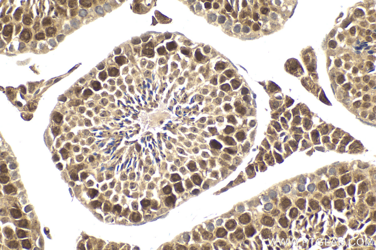 Immunohistochemical analysis of paraffin-embedded mouse testis tissue slide using KHC1987 (MAD2L2 IHC Kit).
