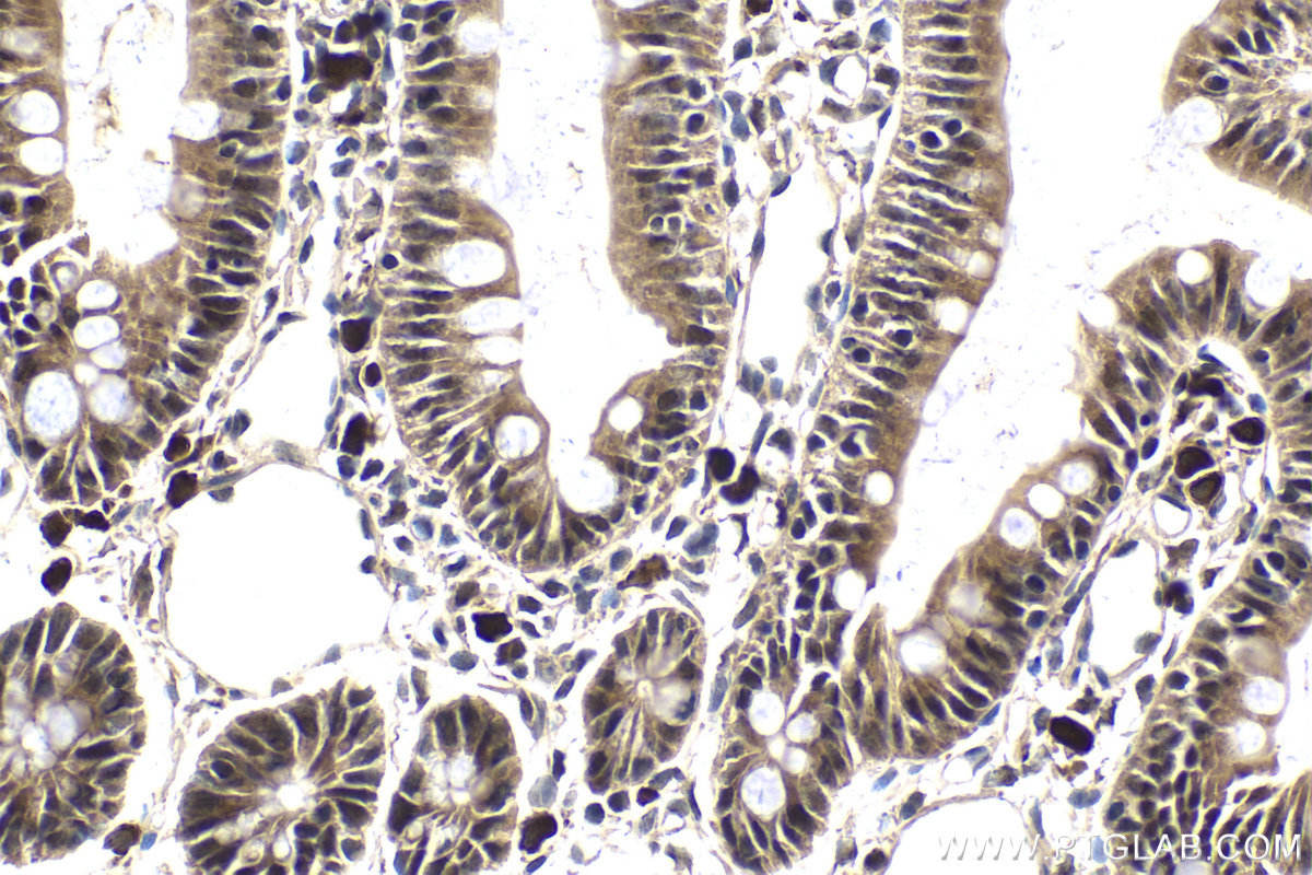 Immunohistochemical analysis of paraffin-embedded rat small intestine tissue slide using KHC1987 (MAD2L2 IHC Kit).