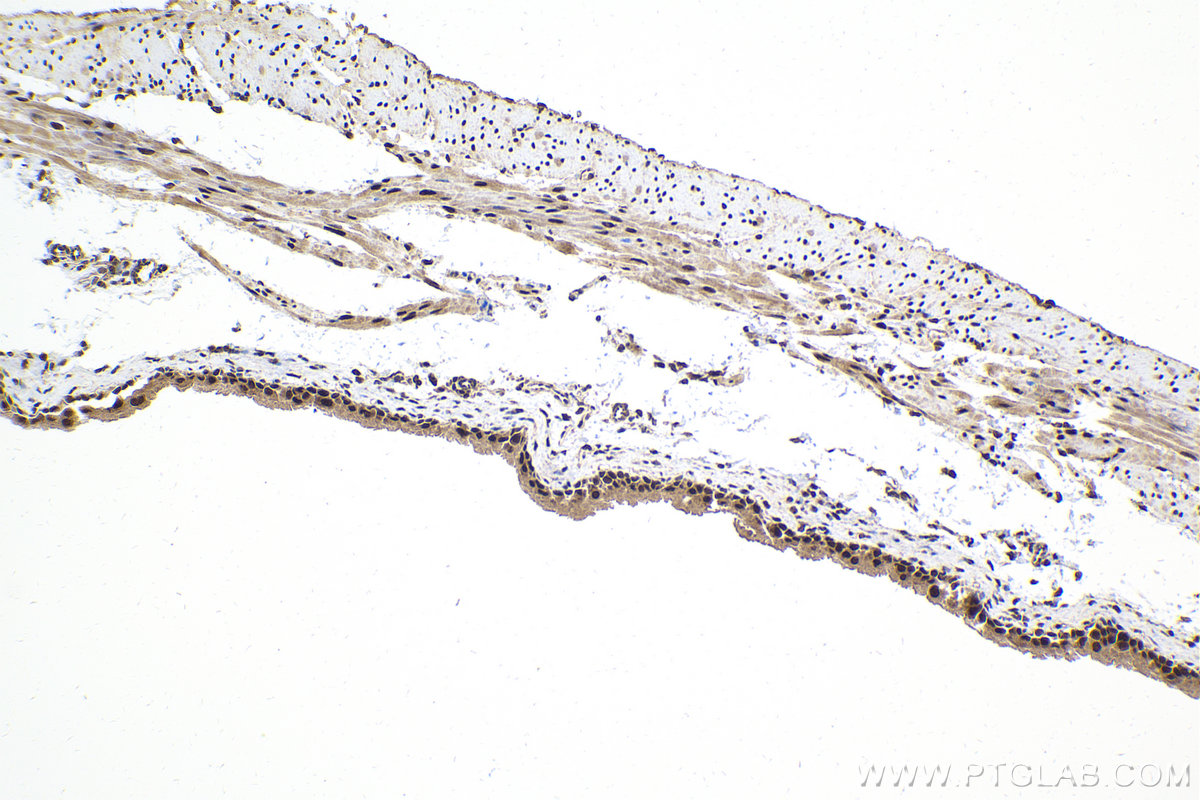 Immunohistochemical analysis of paraffin-embedded mouse bladder tissue slide using KHC1999 (MAFF IHC Kit).