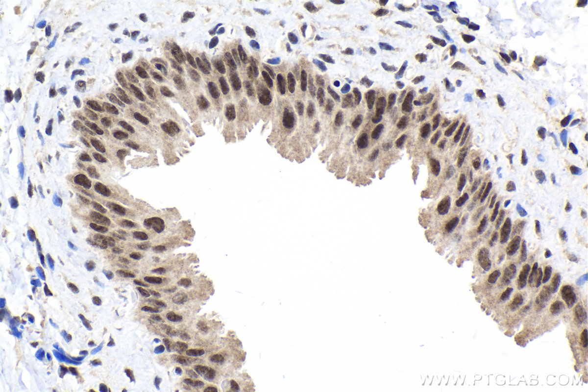 Immunohistochemical analysis of paraffin-embedded rat bladder tissue slide using KHC1999 (MAFF IHC Kit).