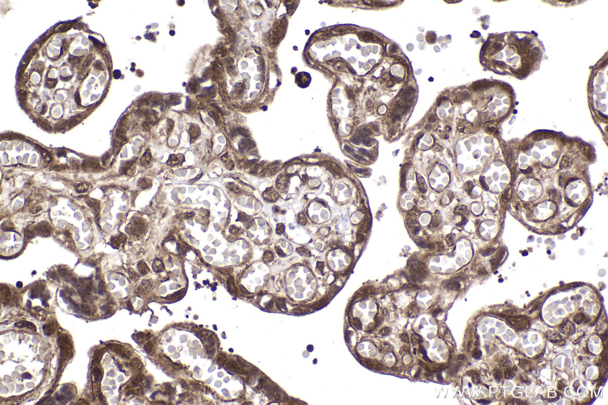Immunohistochemical analysis of paraffin-embedded human placenta tissue slide using KHC2029 (MAGED1 IHC Kit).