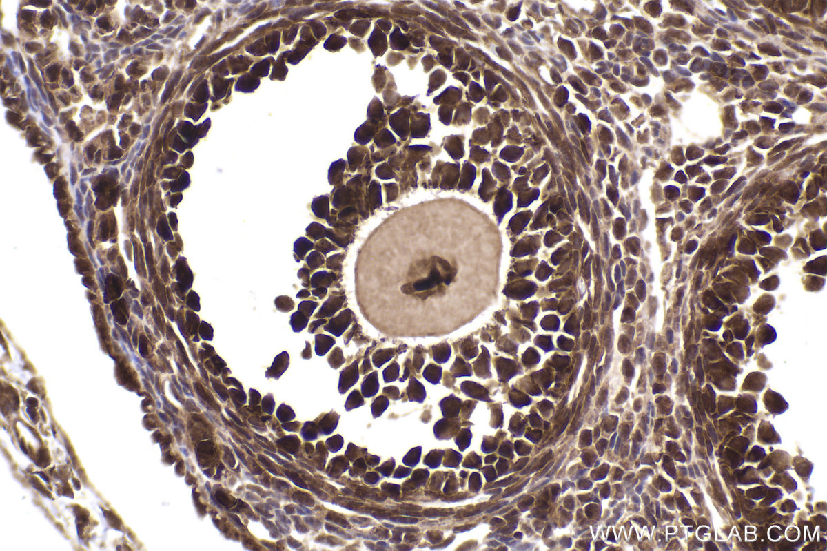 Immunohistochemical analysis of paraffin-embedded mouse ovary tissue slide using KHC2029 (MAGED1 IHC Kit).