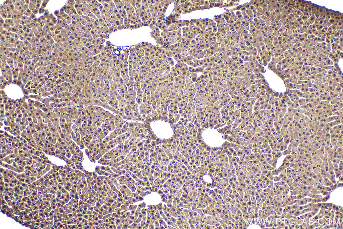 Immunohistochemical analysis of paraffin-embedded mouse liver tissue slide using KHC2029 (MAGED1 IHC Kit).