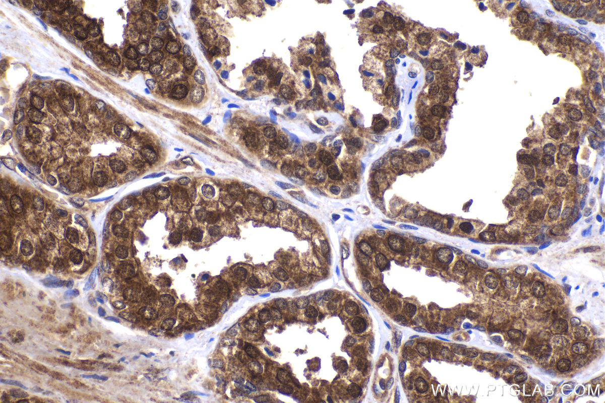 Immunohistochemical analysis of paraffin-embedded human prostate hyperplasia tissue slide using KHC2029 (MAGED1 IHC Kit).