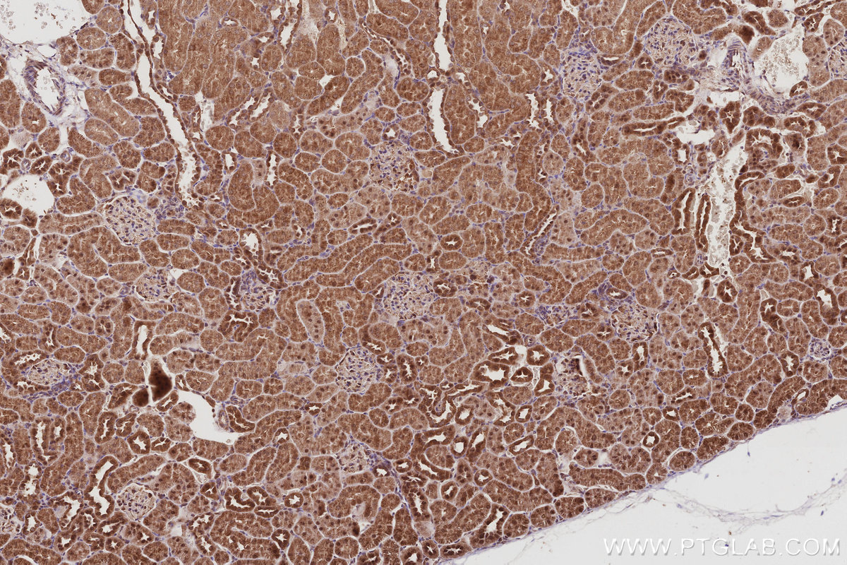 Immunohistochemical analysis of paraffin-embedded rat kidney tissue slide using KHC3043 (MAGED2 IHC Kit). Immunohistochemical analysis of paraffin-embedded rat kidney tissue slide using KHC3043 (MAGED2 IHC Kit).