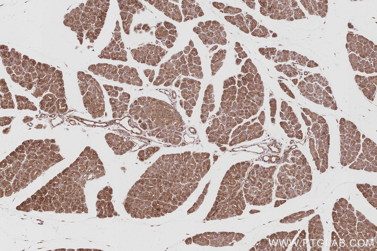 Immunohistochemical analysis of paraffin-embedded rat pancreas tissue slide using KHC3043 (MAGED2 IHC Kit). Immunohistochemical analysis of paraffin-embedded rat pancreas tissue slide using KHC3043 (MAGED2 IHC Kit).