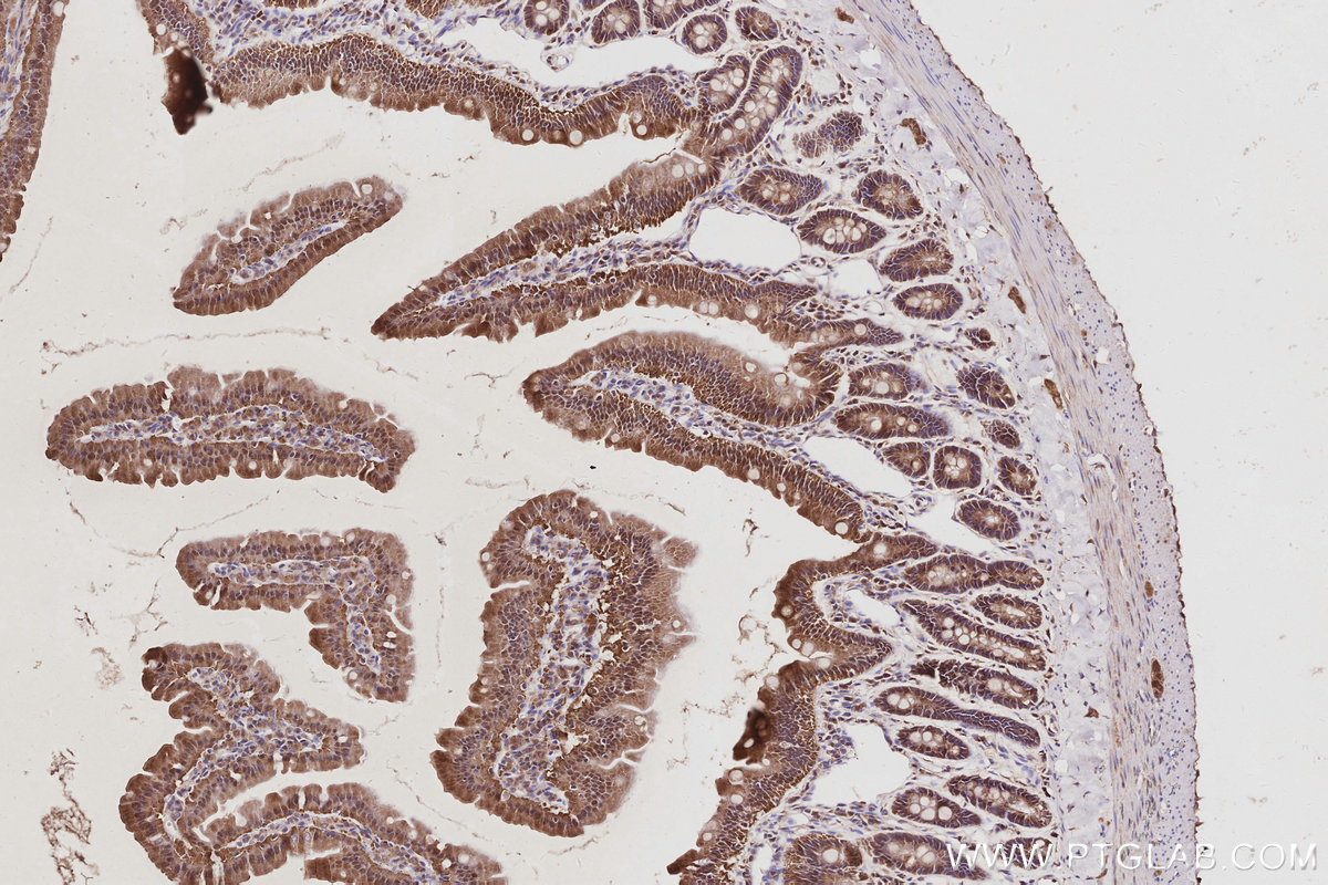Immunohistochemical analysis of paraffin-embedded rat small intestine tissue slide using KHC3043 (MAGED2 IHC Kit). Immunohistochemical analysis of paraffin-embedded rat small intestine tissue slide using KHC3043 (MAGED2 IHC Kit).