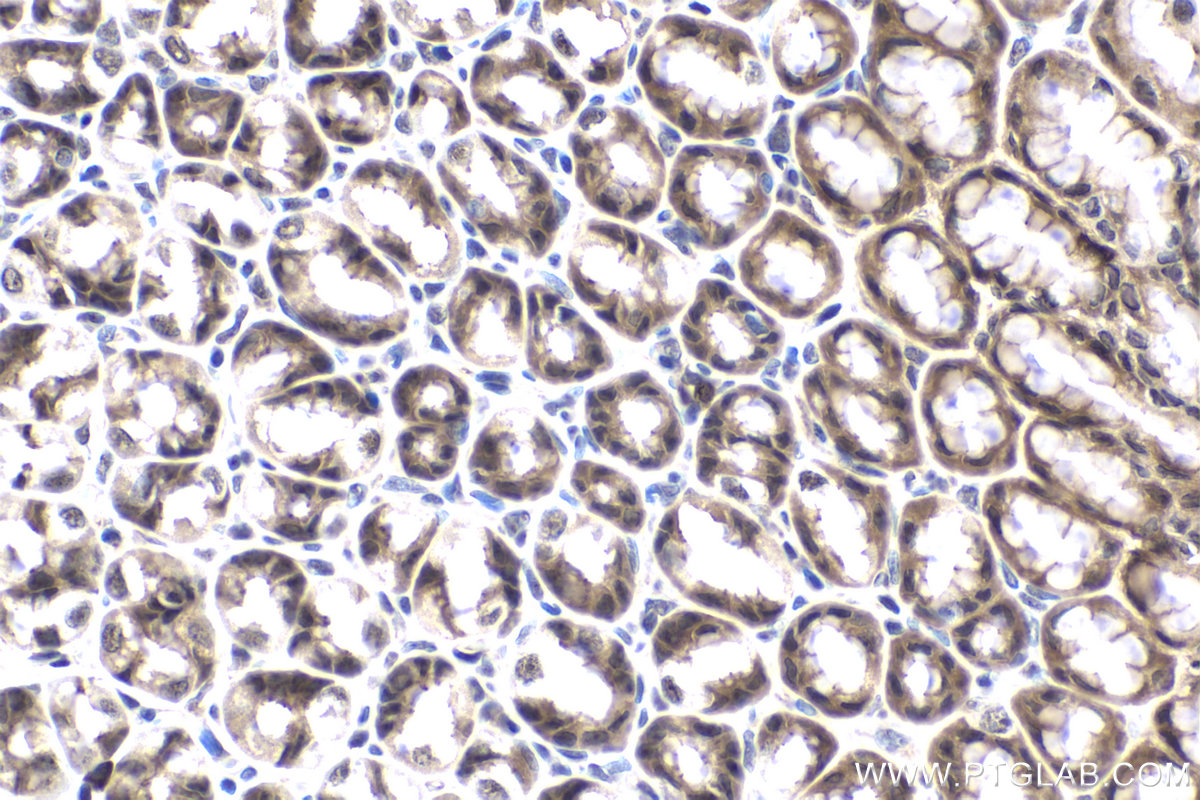 Immunohistochemical analysis of paraffin-embedded rat stomach tissue slide using KHC1670 (MAP2K1/MEK1 IHC Kit).