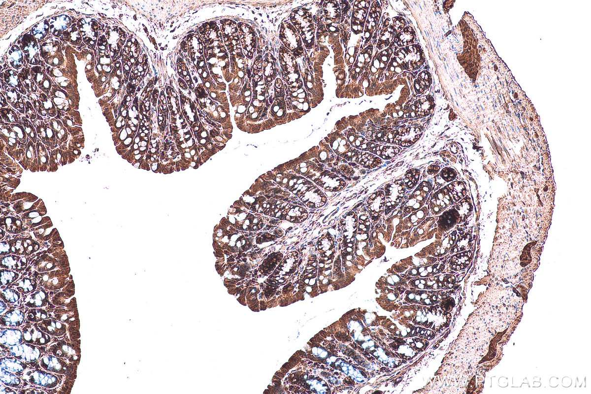 Immunohistochemical analysis of paraffin-embedded mouse colon tissue slide using KHC0986 (MAP2K2 IHC Kit).