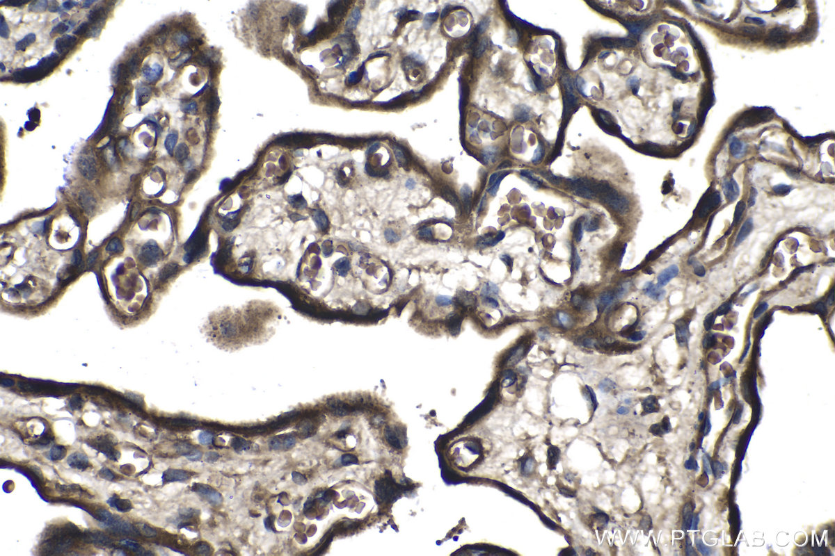 Immunohistochemical analysis of paraffin-embedded human placenta tissue slide using KHC0986 (MAP2K2 IHC Kit).