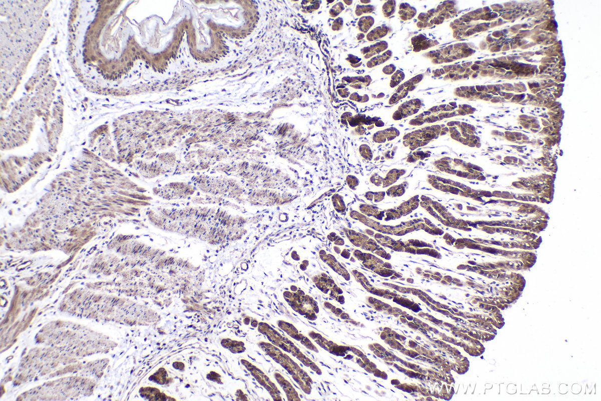Immunohistochemical analysis of paraffin-embedded mouse stomach tissue slide using KHC2080 (MAP3K7/TAK1 IHC Kit).