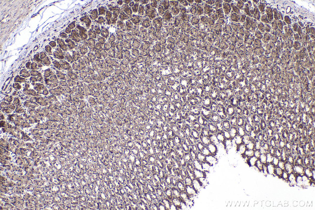 Immunohistochemical analysis of paraffin-embedded rat stomach tissue slide using KHC2080 (MAP3K7/TAK1 IHC Kit).