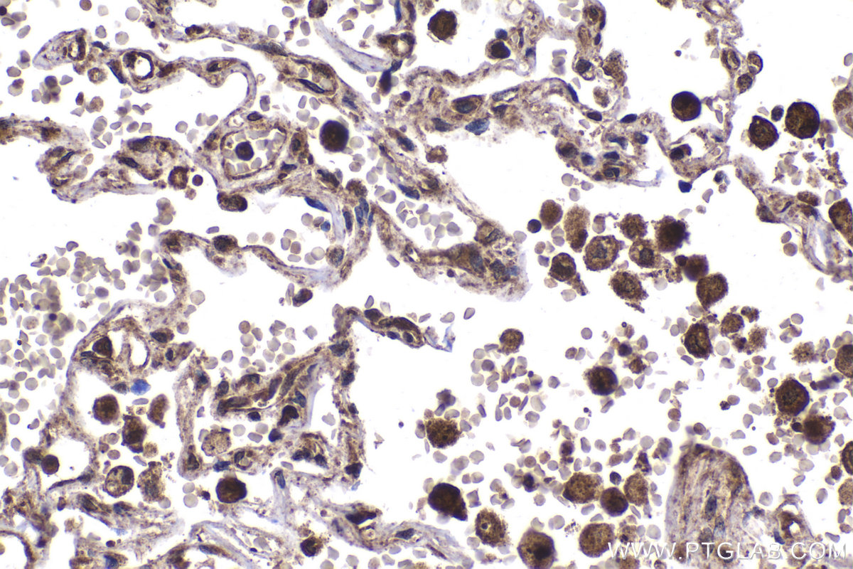 Immunohistochemical analysis of paraffin-embedded human lung tissue slide using KHC2080 (MAP3K7/TAK1 IHC Kit).