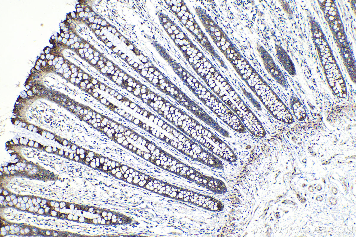 Immunohistochemical analysis of paraffin-embedded human colon tissue slide using KHC1236 (MAP7 IHC Kit).