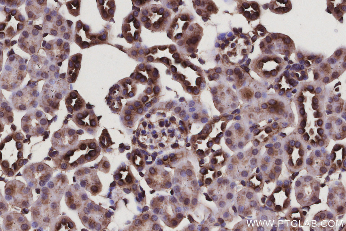 Immunohistochemical analysis of paraffin-embedded mouse kidney tissue slide using KHC3102 (MAP7D1 IHC Kit). Immunohistochemical analysis of paraffin-embedded mouse kidney tissue slide using KHC3102 (MAP7D1 IHC Kit).