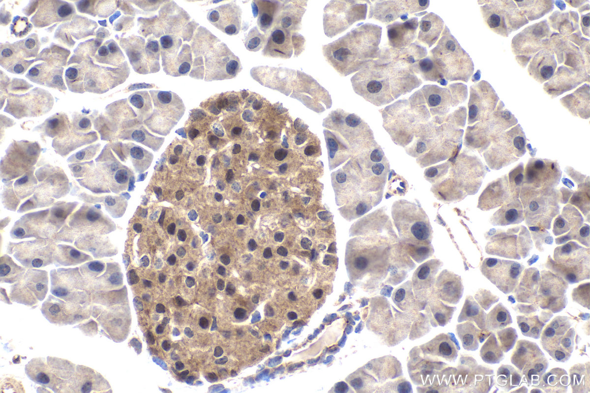 Immunohistochemical analysis of paraffin-embedded mouse pancreas tissue slide using KHC1626 (MAPK10 IHC Kit).