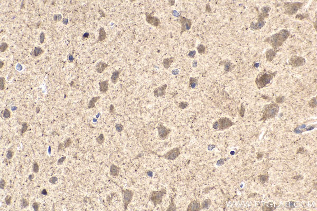 Immunohistochemical analysis of paraffin-embedded mouse brain tissue slide using KHC2010 (MAPK8IP1/JIP1 IHC Kit).