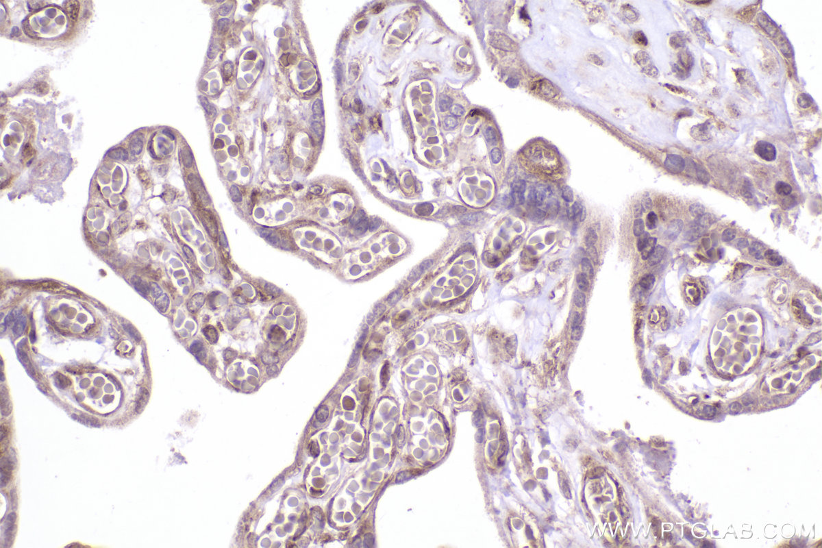 Immunohistochemical analysis of paraffin-embedded human placenta tissue slide using KHC2494 (MAPRE1/EB1 IHC Kit).