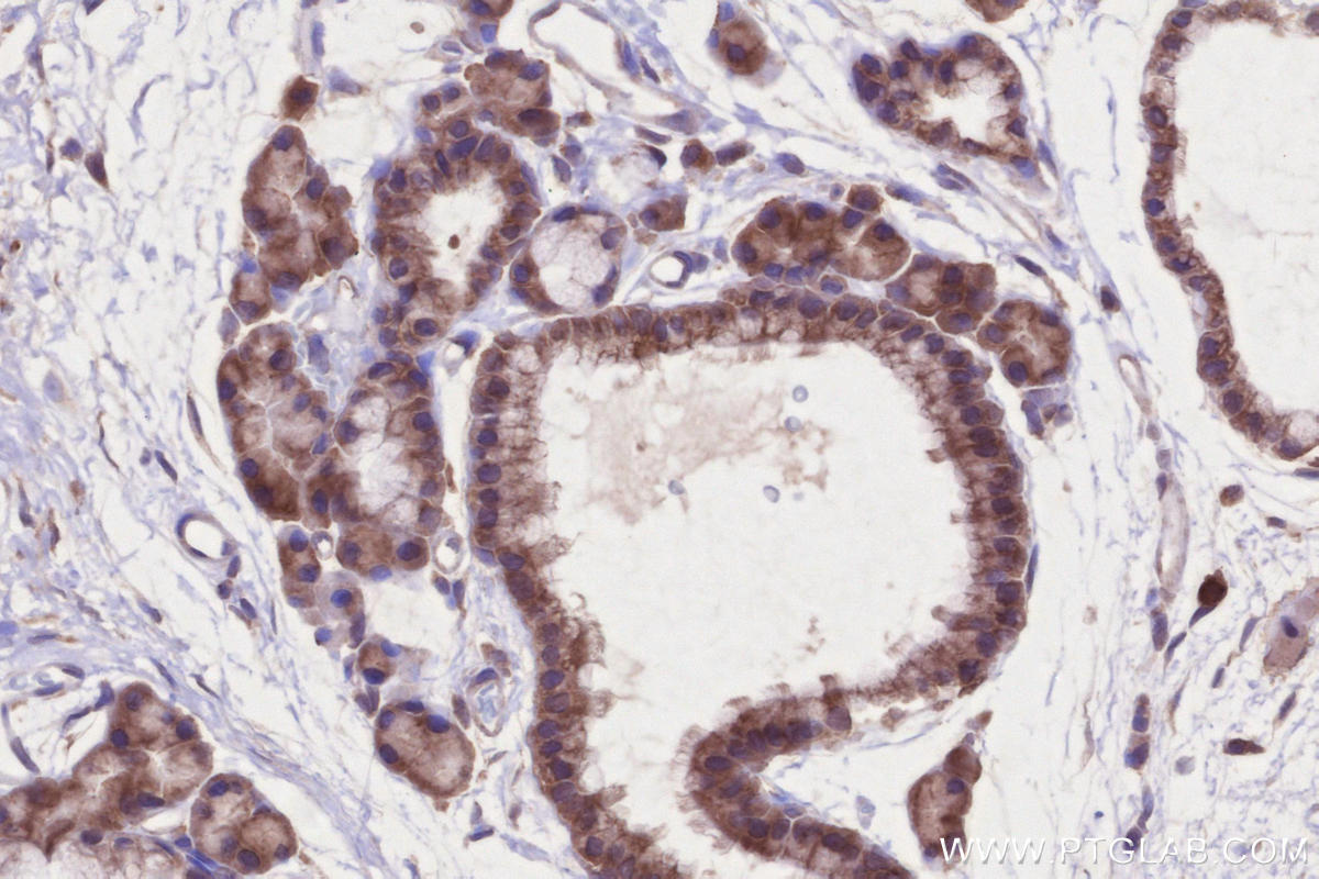 Immunohistochemical analysis of paraffin-embedded rat thyroid gland tissue slide using KHC2675 (MARVELD2 IHC Kit).