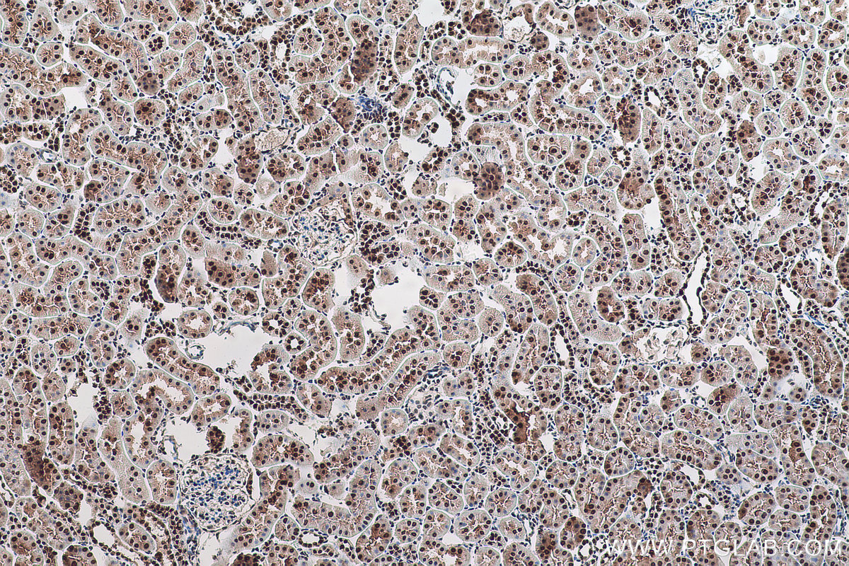 Immunohistochemical analysis of paraffin-embedded rat kidney tissue slide using KHC0910 (MAT2A IHC Kit).