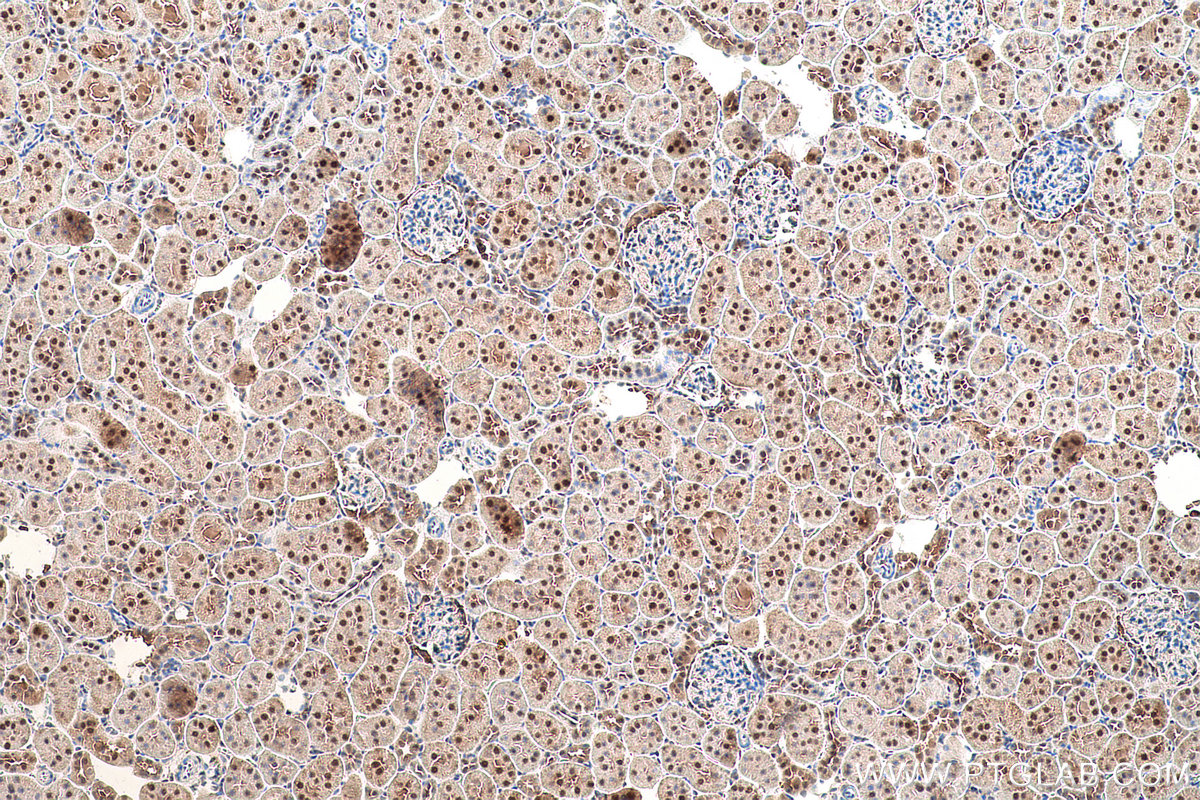 Immunohistochemical analysis of paraffin-embedded rat kidney tissue slide using KHC0854 (MAT2B IHC Kit).