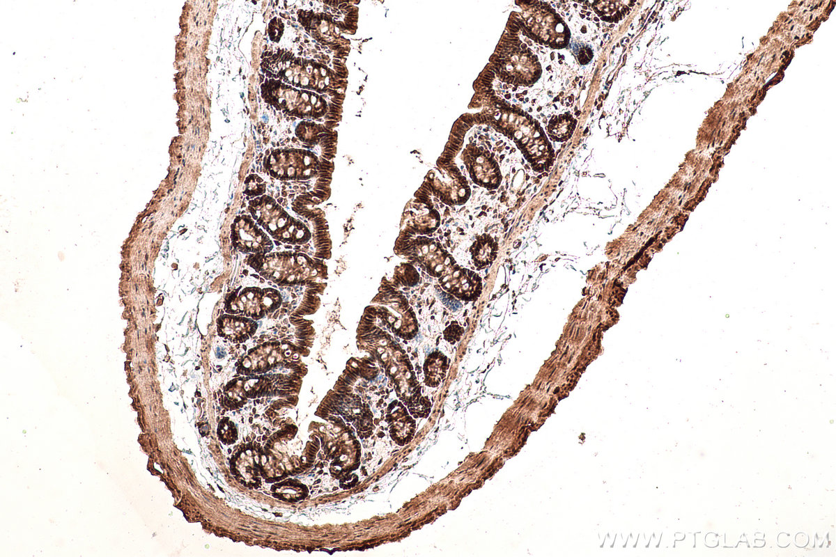 Immunohistochemical analysis of paraffin-embedded rat colon tissue slide using KHC0854 (MAT2B IHC Kit).