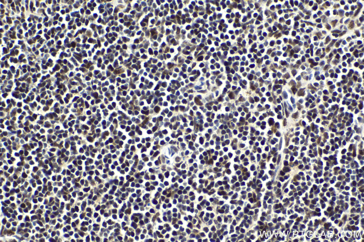 Immunohistochemical analysis of paraffin-embedded mouse spleen tissue slide using KHC1641 (MAX IHC Kit).