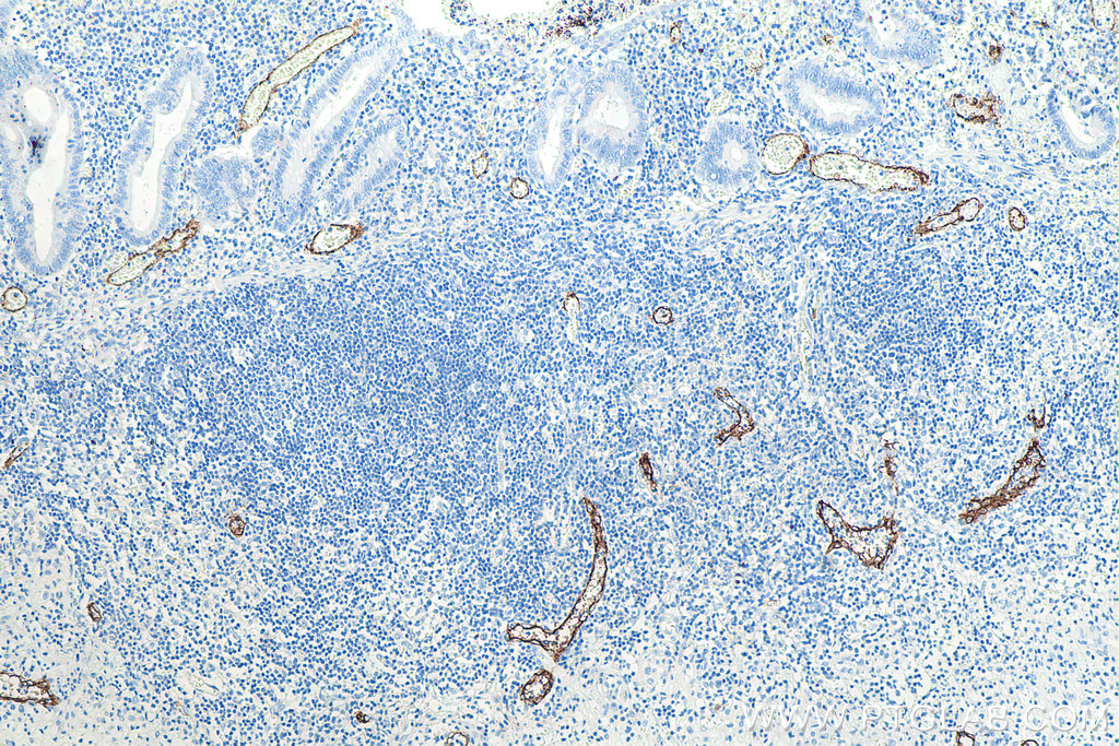 Immunohistochemical analysis of paraffin-embedded human appendicitis tissue slide using KHC0025 (MAdCAM1 IHC Kit).